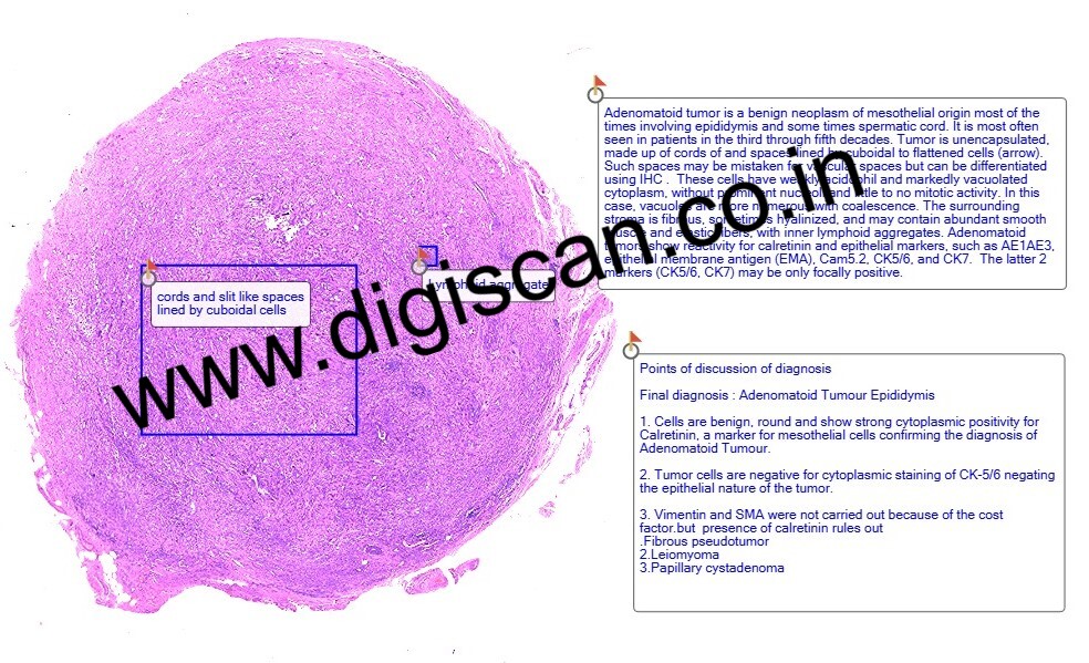 MD Pathology Exam Cases (Digital Slides & Spot Diagnosis Cases)